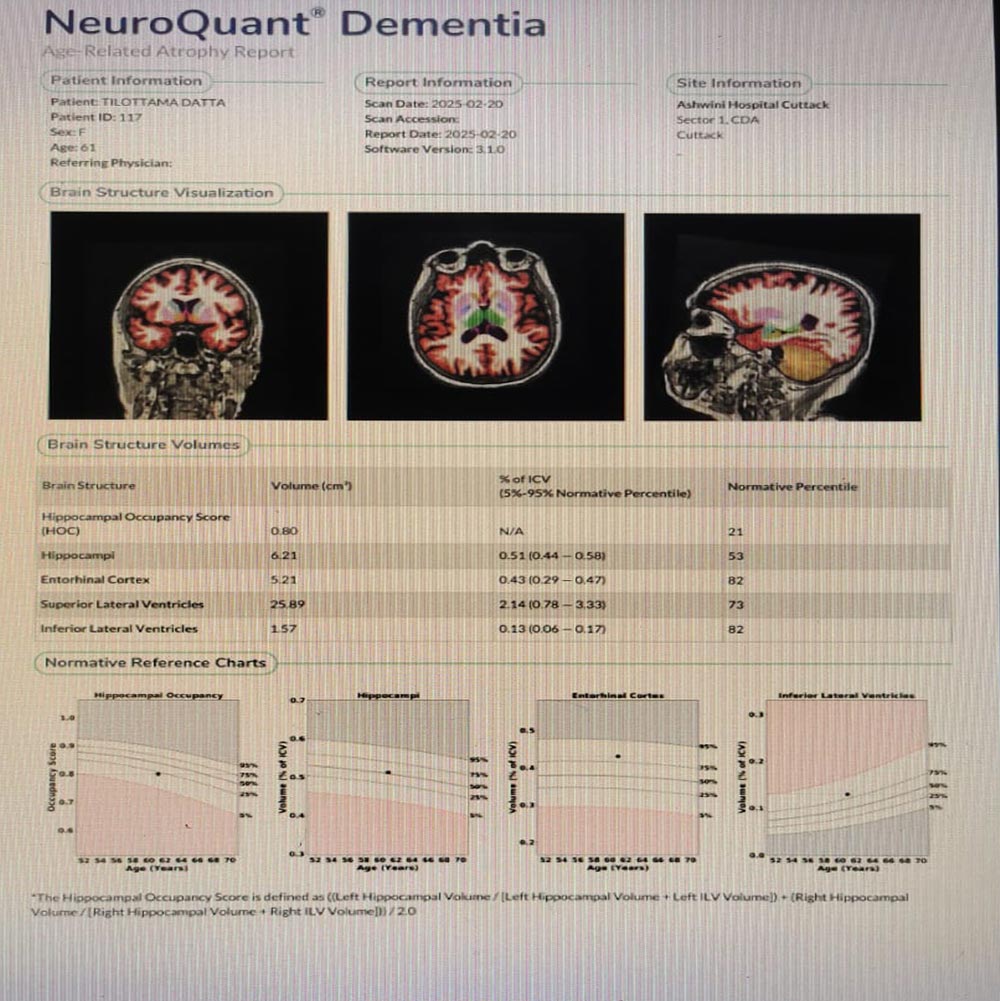 Brain Volume Analysis Brain Volume Analysis